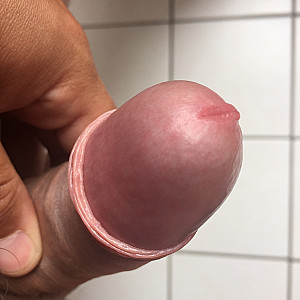 my penis gallery image