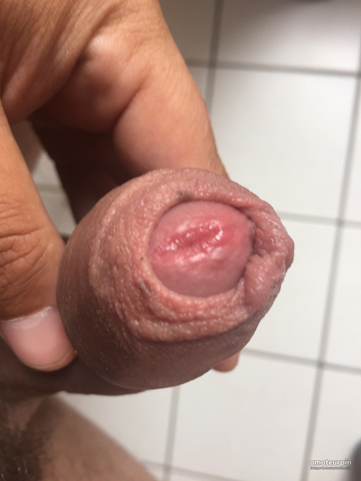 my penis gallery image