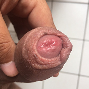 my penis gallery image