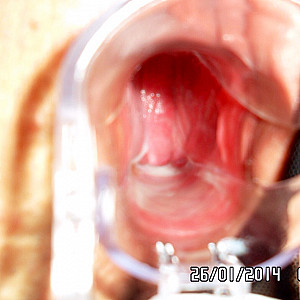 wet pussy and speculum gallery image