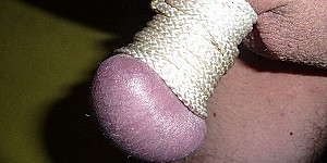Allerlei First Thumb Image