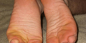 Füße Sohlen Zehen First Thumb Image