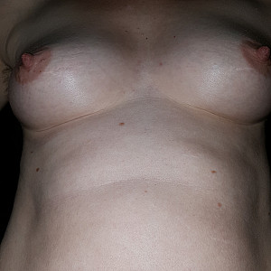 my breasts gallery image