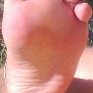 my feets gallery image