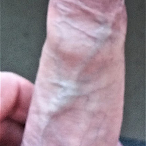 DickPic 1 Galeriebild