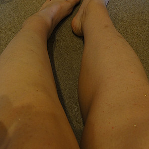Legs and Feet Galerie
