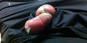 Im Kondom eingepackt First Thumb Image