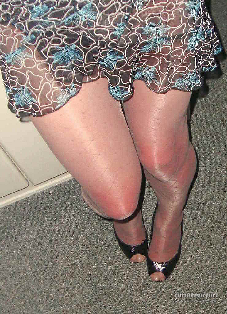 my legs gallery image