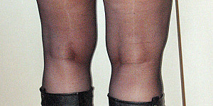 Body mit Nylons und Strumpfhose First Thumb Image