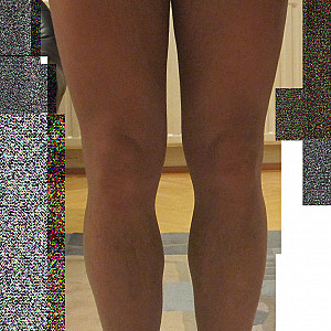 presentation in a pantyhose gallery image