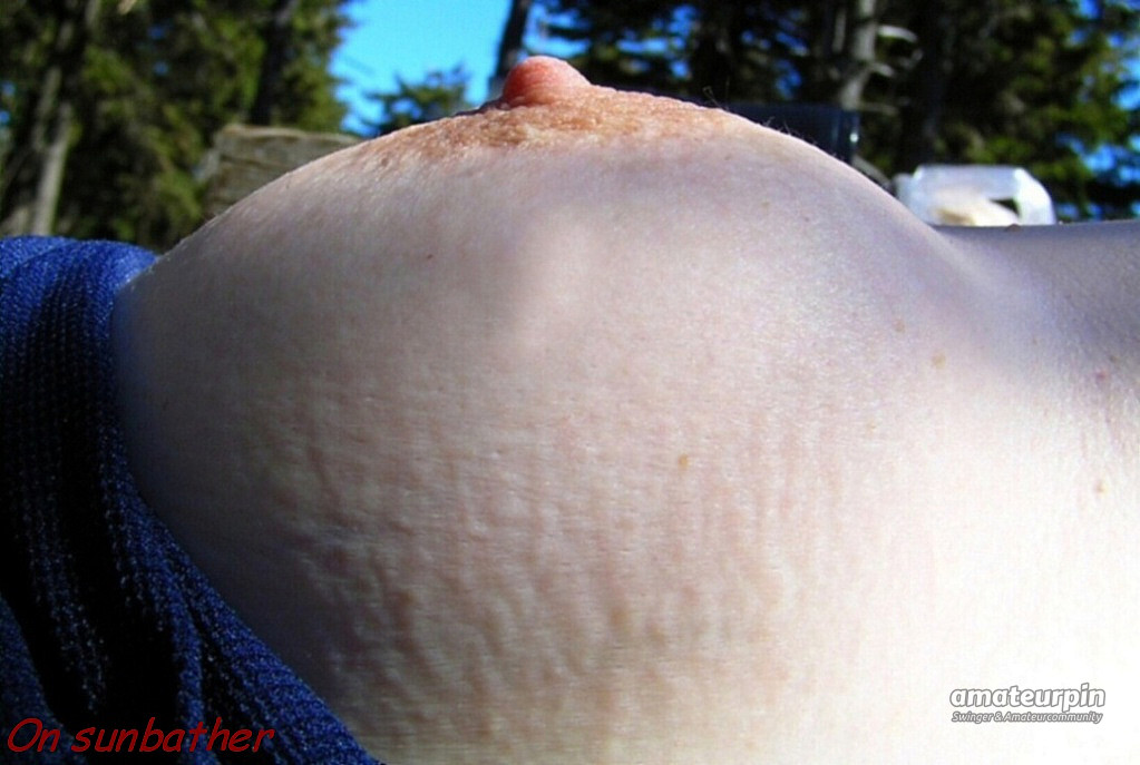 My breast outdoors gallery image