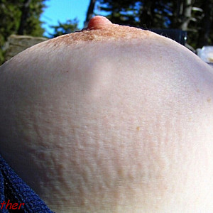 My breast outdoors gallery image