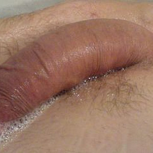 my cock gallery image