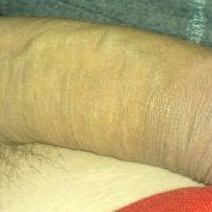 my cock gallery image