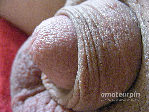 Penis gallery image