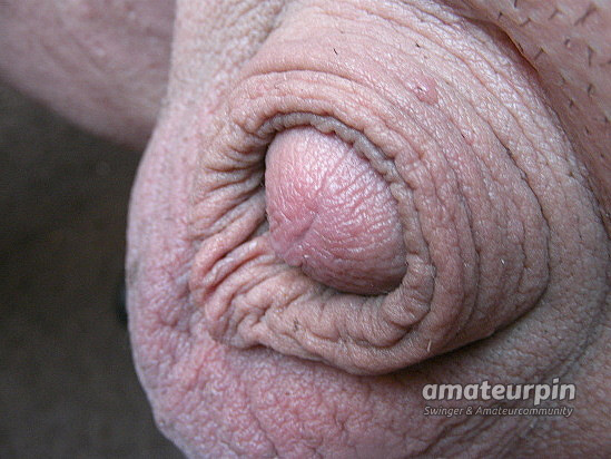 Penis gallery image