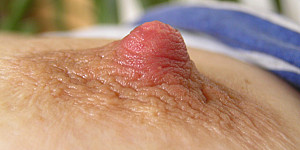 nipple First Thumb Image