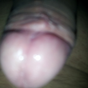 My dick gallery image