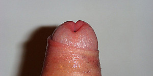 Hart und Willig First Thumb Image