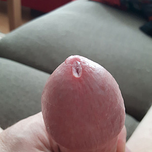 Precum / Lusttropfen Galerie