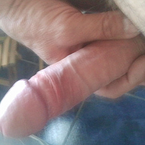 My dick gallery image