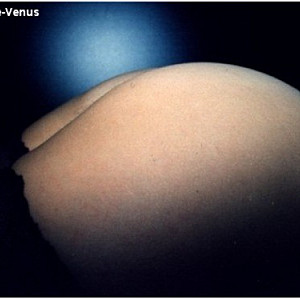 Venus ind Nylons Galerie