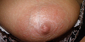 Tits 1 First Thumb Image