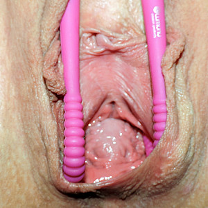 lipspreader in closeup gallery image