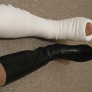 Horny with Short Leg Cast gallery image