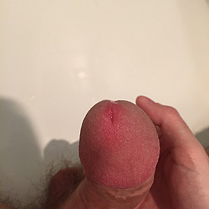 My dick gallery image