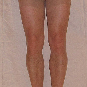 presented in nylons gallery image