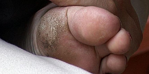 sommerfüße First Thumb Image