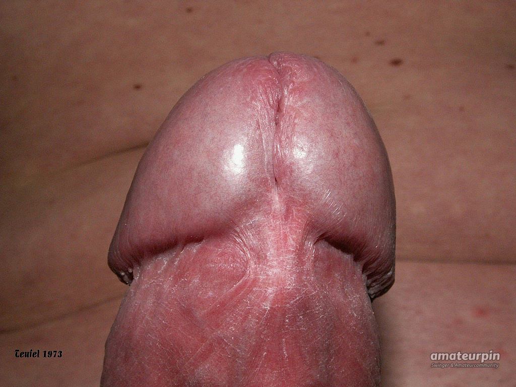 my cock with rrings gallery image