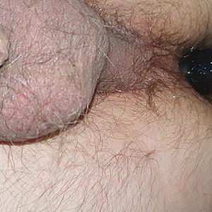 hairy asscunt gallery image