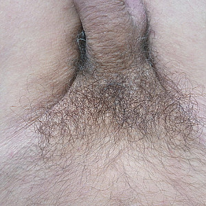 First image of Oliver1962's Gallery - my soft hairy dick