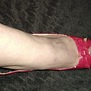Pinke lack High Heels Galeriebild