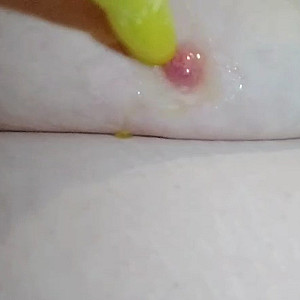 Eis an meinem Nippel Galeriebild