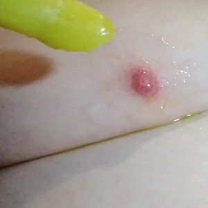 Eis an meinem Nippel Galeriebild