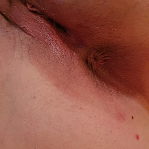 hairy and shaved...before and after pictures gallery image