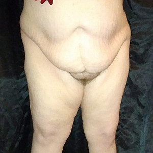 Meine dicken Titten mit einer Schleife Galeriebild