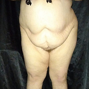 Schwarze Nippelklemmen Galeriebild