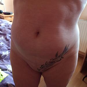 To bare all or not to bare all? gallery image