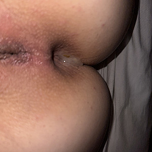 anal gallery image