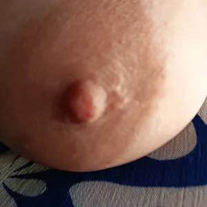 A boob today gallery image
