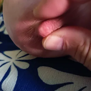 A boob today gallery image