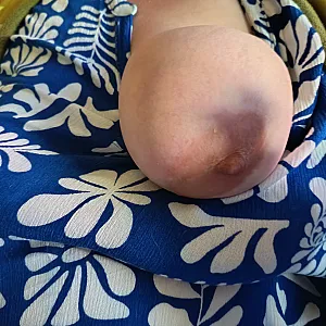 A boob today gallery image